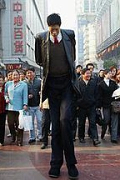 异于常人：巨人症